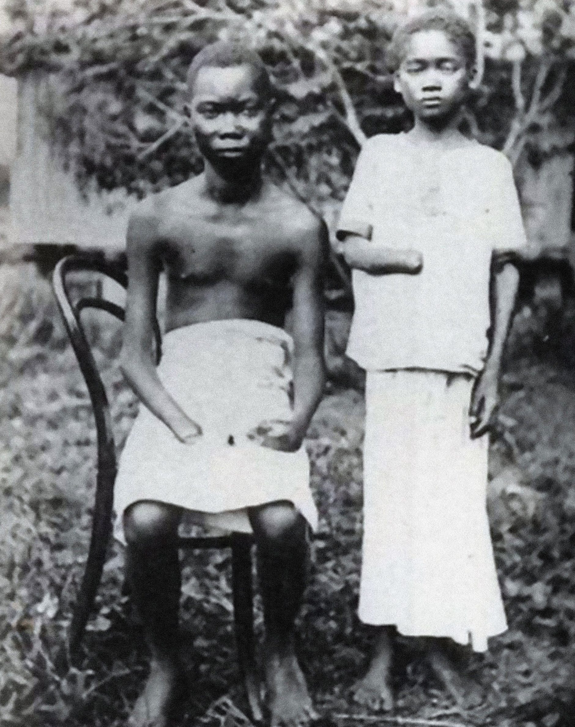 Mola i Yoko, žrtve zločina počinjenih u Slobodnoj Državi Kongo, oko 1900. godine.